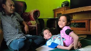 Potret Dewi dan Putri, Bocah Kembar Siam Dempet Perut di Garut