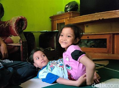 Potret Dewi dan Putri, Bocah Kembar Siam Dempet Perut di Garut
