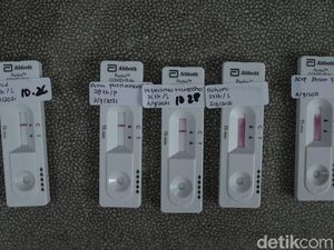 Banyak Provinsi Belum Update Kasus Corona Lebih dari 21 Hari, Ini Respons Satgas