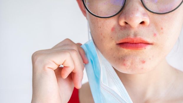 Wearing mask for prolonged periods can damage the skin.