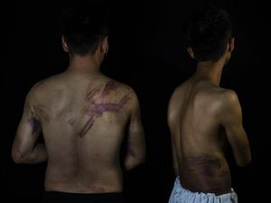 Bukti Nyata Kekerasan Taliban Terhadap Wartawan Afghanistan