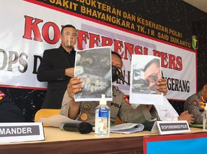 2 Jenazah Korban Kebakaran Lapas Tangerang Teridentifikasi Lewat Gigi 2 Jenazah Korban Kebakaran Lapas Tangerang Teridentifikasi Lewat Gigi