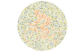 Kesulitan Lihat Siluet Gambar Ini? Coba Cek ke Dokter Mata