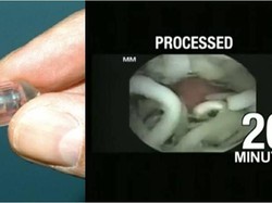 Proses Pencernaan Mie Instan di dalam Perut Ini Perlu Diketahui Penggemar Mie