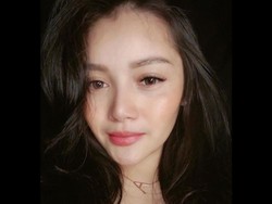 Tak Penuhi Panggilan Polisi, Mawar AFI Jalani Operasi Rahang