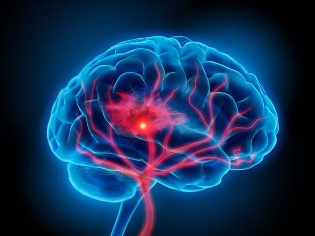 Waspadai 3 Kesalahan Minum Kopi yang Bisa Menurunkan Fungsi Otak