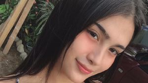 Kecantikan Wanita Ini Bikin Pria Terpesona, Tapi Foto Masa Lalunya Mengejutkan