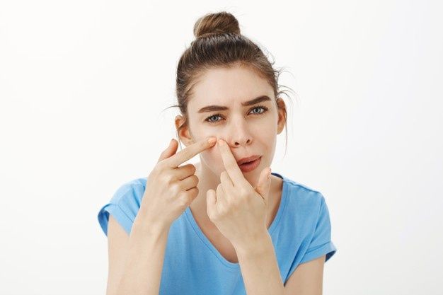 Alergi kosmetik juga bisa ditandai dengan munculnya jerawat dan komedo.