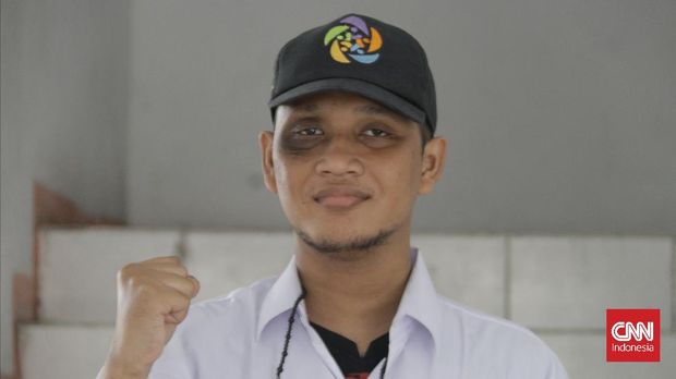 Penyandang Disabilitas Intelektual, Nanda 25 tahun. CNN Indonesia/Farid Rahman