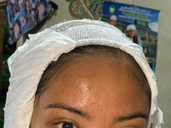 Transformasi Pengantin Sunda Viral Bikin Melongo, Wajah Jerawat Jadi Flawless