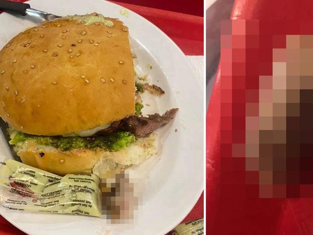 Hiiii! Wanita Ini Temukan Potongan Jari Manusia di Burgernya Hiiii! Wanita Ini Temukan Potongan Jari Manusia di Burgernya