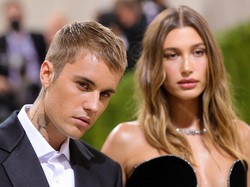 Hailey Baldwin Istri Justin Bieber Idap Kista Ovarium Sebesar Apel