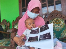 Bayi Atta di Boyolali Mengalami Jantung Bocor