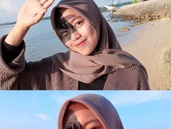 Hijabers Viral Dibully karena Ada Tanda Lahir di Wajah, Begini Nasibnya Kini