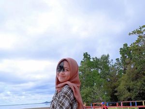 Cerita Hijabers Remaja yang Viral Di-Bully karena Punya Tanda Lahir di Wajah