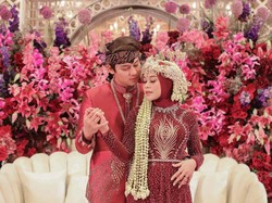 Kecantikan Lesti Kejora Dicibir, Rizky Billar Beri Jawaban Menohok