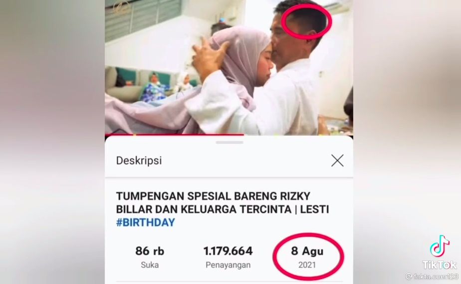 Viral rambut ayah Lesti Kejora