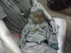 Bayi 10 Bulan Jadi Manusia Silver, Dokter Jelaskan Bahayanya