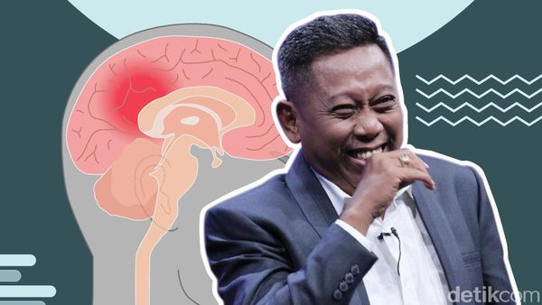 Sederet Gejala Perdarahan Otak, Kondisi yang Dialami Tukul Arwana