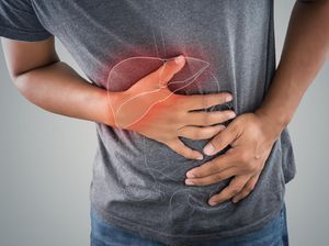 Ini Ciri-Ciri Penyakit Liver yang Sudah Parah dan Cara Mencegahnya Ini Ciri-Ciri Penyakit Liver yang Sudah Parah dan Cara Mencegahnya