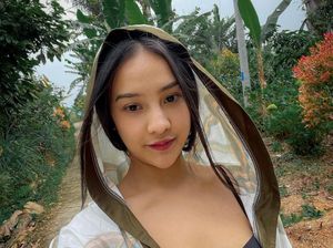 Yang Harus Dilakukan Anya Geraldine Usai Jalani Operasi Yang Harus Dilakukan Anya Geraldine Usai Jalani Operasi