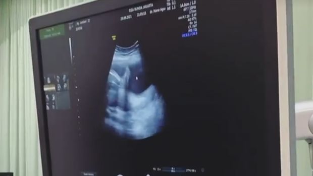 Lesti hamil bayi kembar