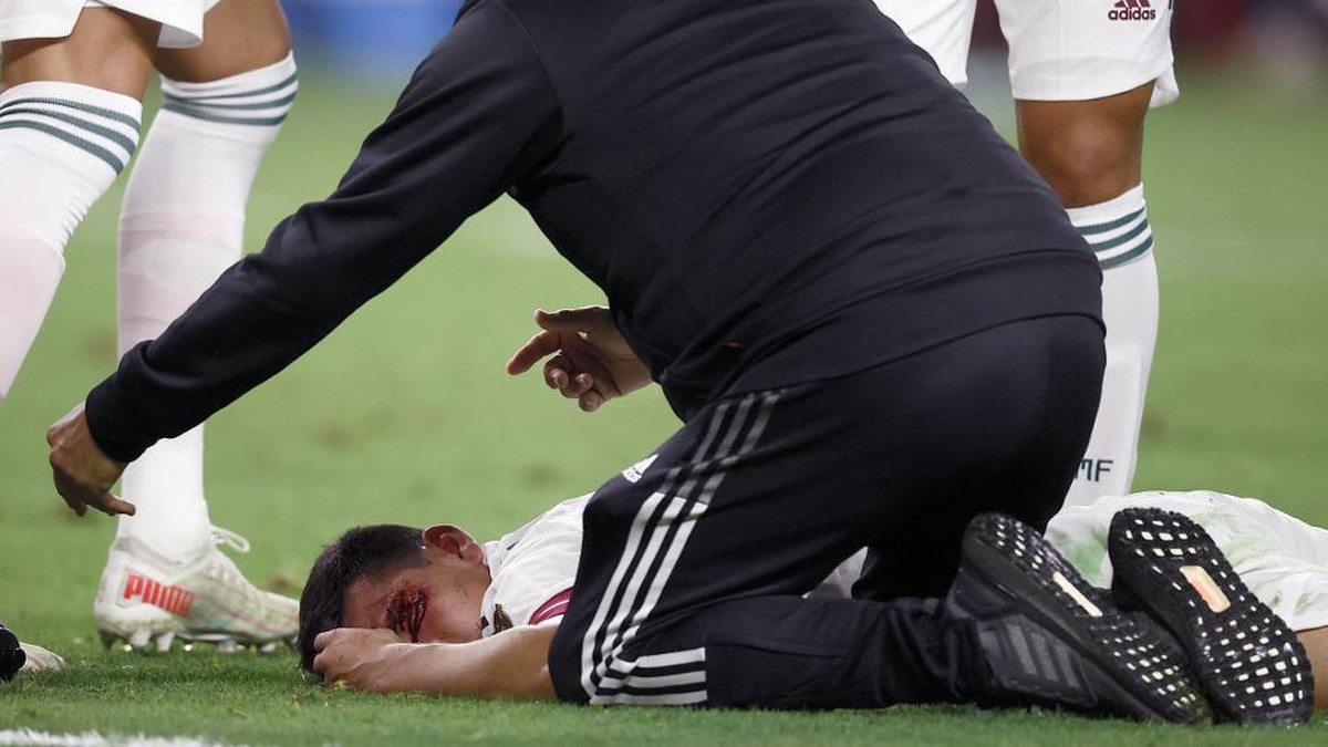 Cedera horor striker Napoli dan Timnas Meksiko Hirving Lozano (Getty Images via AFP/TOM PENNINGTON)