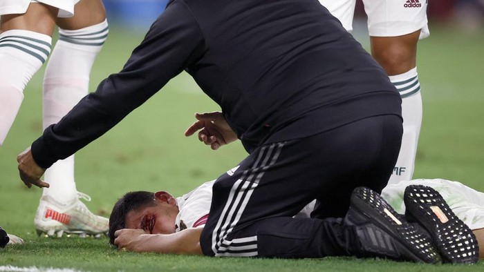 ARLINGTON, TEXAS - JULY 10: (EDITORS NOTE: Image contains graphic content.) Medical officials attend to Hirving Lozano #22 of Mexico after his collision with Marvin Phillip #1 of Trinidad and Tobago in the first half in the 2021 CONCACAF Gold Cup Group A Match at AT&T Stadium on July 10, 2021 in Arlington, Texas.   Tom Pennington/Getty Images/AFP (Photo by TOM PENNINGTON / GETTY IMAGES NORTH AMERICA / Getty Images via AFP)