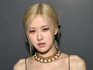 Curhat Rose Blackpink Pernah Mengidap Herpes Zoster Curhat Rose Blackpink Pernah Mengidap Herpes Zoster