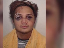 Korbannya Angkat Bicara, Foto Reynhard Sinaga Babak Belur Dirilis Polisi