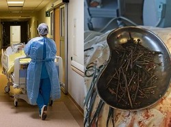 Aneh Banget! Pria Ini Tiba-tiba Hobi Makan Paku dan Baut