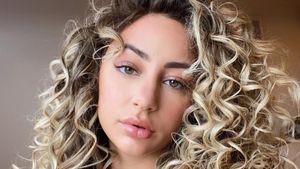 Ini Ratu Kecantikan Belanda yang Batal Ikut Miss World karena Anti-vaksin
