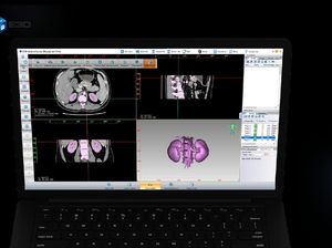 Begini Penerapan Teknologi 3D Printing di Dunia Kesehatan