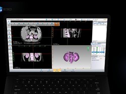 Begini Penerapan Teknologi 3D Printing di Dunia Kesehatan