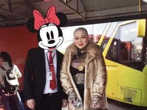 Sulit Dapat Pasangan Karena Penampilannya, Wanita Ini Tawarkan Hadiah Mewah