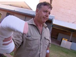 Tangan Operator Tur di Australia Digigit Buaya: Ah, Cuma Sedikit Sakit