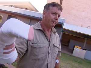 Tangan Operator Tur di Australia Digigit Buaya: Ah, Cuma Sedikit Sakit Tangan Operator Tur di Australia Digigit Buaya: Ah, Cuma Sedikit Sakit