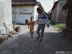 Tolong! Bocah di Klaten Ini Mendadak Buta, Mau Operasi Terbentur Biaya