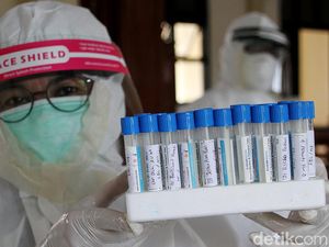 Kian Kencang Desakan Hapus Tes PCR dari Syarat Penerbangan Kian Kencang Desakan Hapus Tes PCR dari Syarat Penerbangan