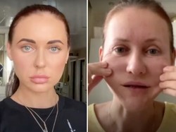 Salah Perawatan, Wajah Wanita Ini Terlihat Lebih Tua 10 Tahun dalam Semalam