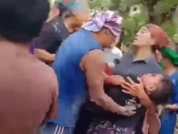 Bondet Meledak Lukai Empat Bocah Diduga Milik Bandit, Polisi Kejar Pemilik