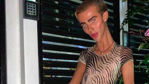 Transformasi Tubuh Bintang Reality TV yang Mengkhawatirkan, Dikira Anoreksia