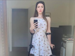 Kisah Wanita yang Kakinya Diamputasi, Kini Sukses Jadi Model