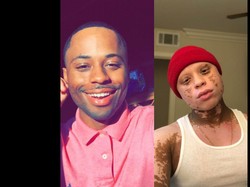 Gegara Obat Jerawat, Pria Ini Kena Sindrom Langka hingga Warna Kulit Berubah