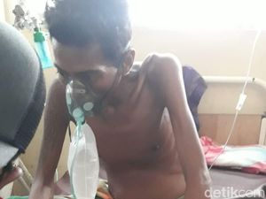 Tolong! Pria di Dompu NTB Alami Tumor Ganas di Perut Hidup Sebatang Kara Tolong! Pria di Dompu NTB Alami Tumor Ganas di Perut Hidup Sebatang Kara