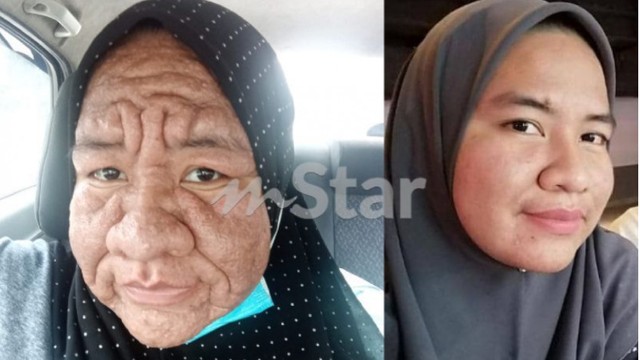 Hamil 3 Bulan, Wajah Wanita Ini Mendadak Berubah Seperti Nenek-nenek