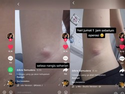 Curhat Wanita Harus Operasi Benjolan Tumor gara-gara Cukur Bulu Ketiak