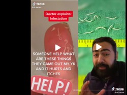 Hii... Viral Muncul Cacing Halus di Jari Usai Garuk Anus