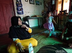 Bocah Bandung Usus Bocor Harus Operasi Ketiga, Ortu Kesulitan Biaya