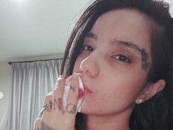 Sheila Marcia Jelaskan Penyebab Luka Lebam di Mata